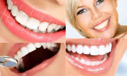 Diş Tasarımı Nedir ve Neden Önemlidir?
