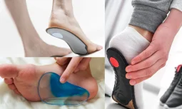 Düz Tabanlık Tedavisi: Düz Tabanlık Nedir ve Neden Oluşur?