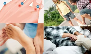 Başparmak Kireçlenmesi Nedir?